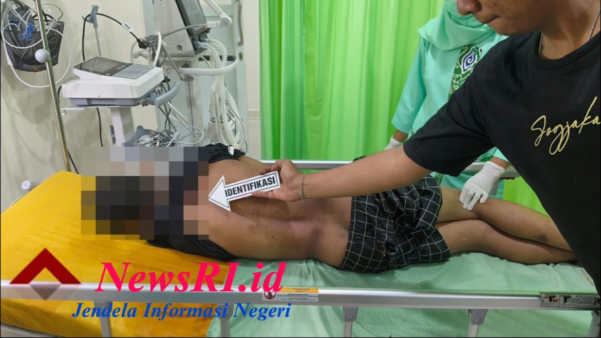Seorang Pelajar SMP di Pekalongan Tersambar Petir Saat sedang Main Bola