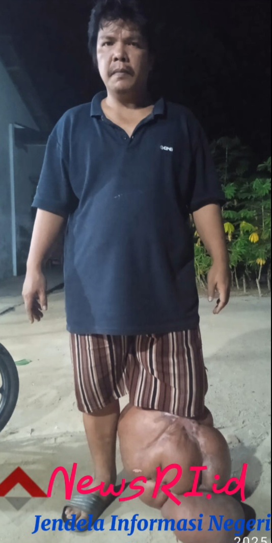 Penyandang Disabilitas Desa Batu 13 Butuh Perhatian dan Bantuan Pemerintah